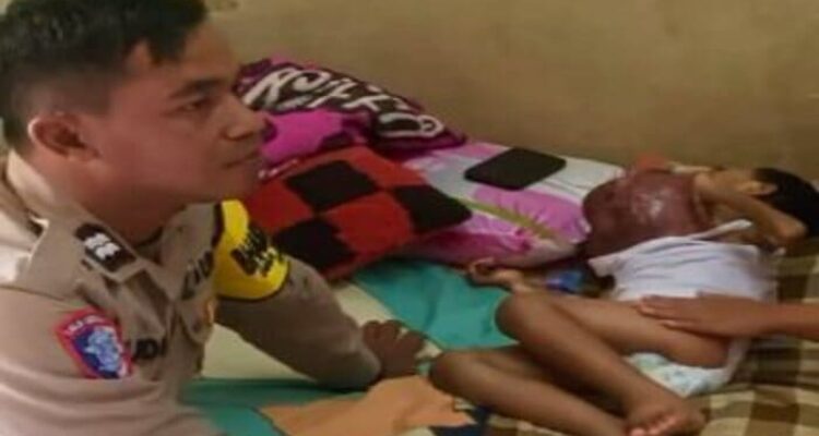 Bhabinkamtibmas dan Dinsos Lamongan mendampingi anak penderita kanker di rumahnya