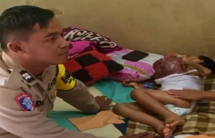 Bhabinkamtibmas dan Dinsos Lamongan mendampingi anak penderita kanker di rumahnya